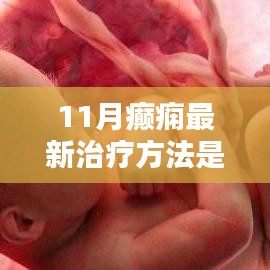 揭秘革命性科技突破，最新癫痫治疗技术，为癫痫患者带来福音