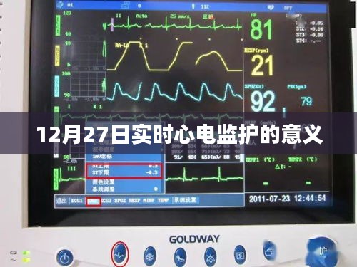 实时心电监护的意义与重要性分析