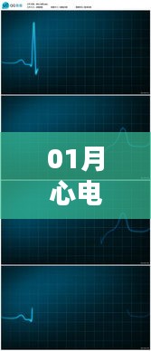心电图素材一月热门精选