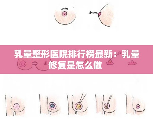 乳晕整形医院排行榜最新：乳晕修复是怎么做 