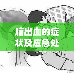 脑出血的症状及应急处理，百度来揭秘！
