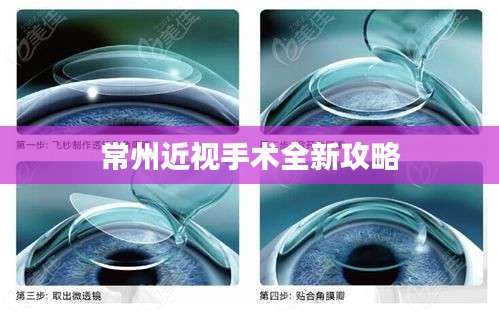 常州近视手术全新攻略