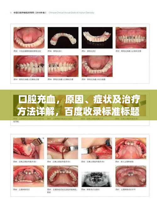 口腔充血，原因、症状及治疗方法详解，百度收录标准标题